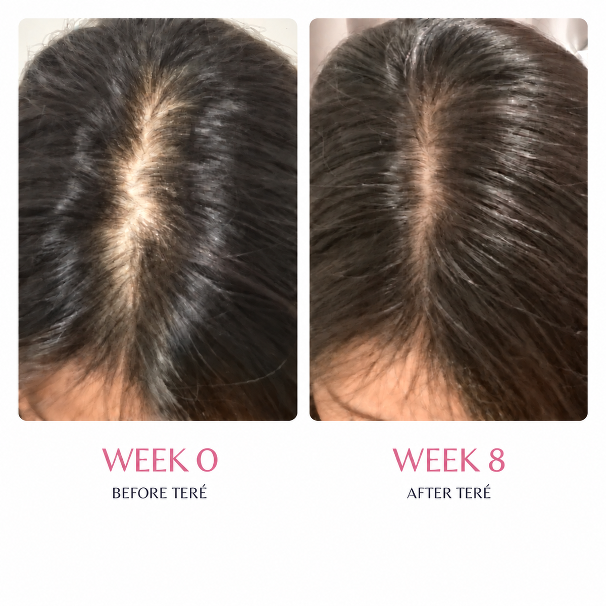 Hair Growth Revive Serum