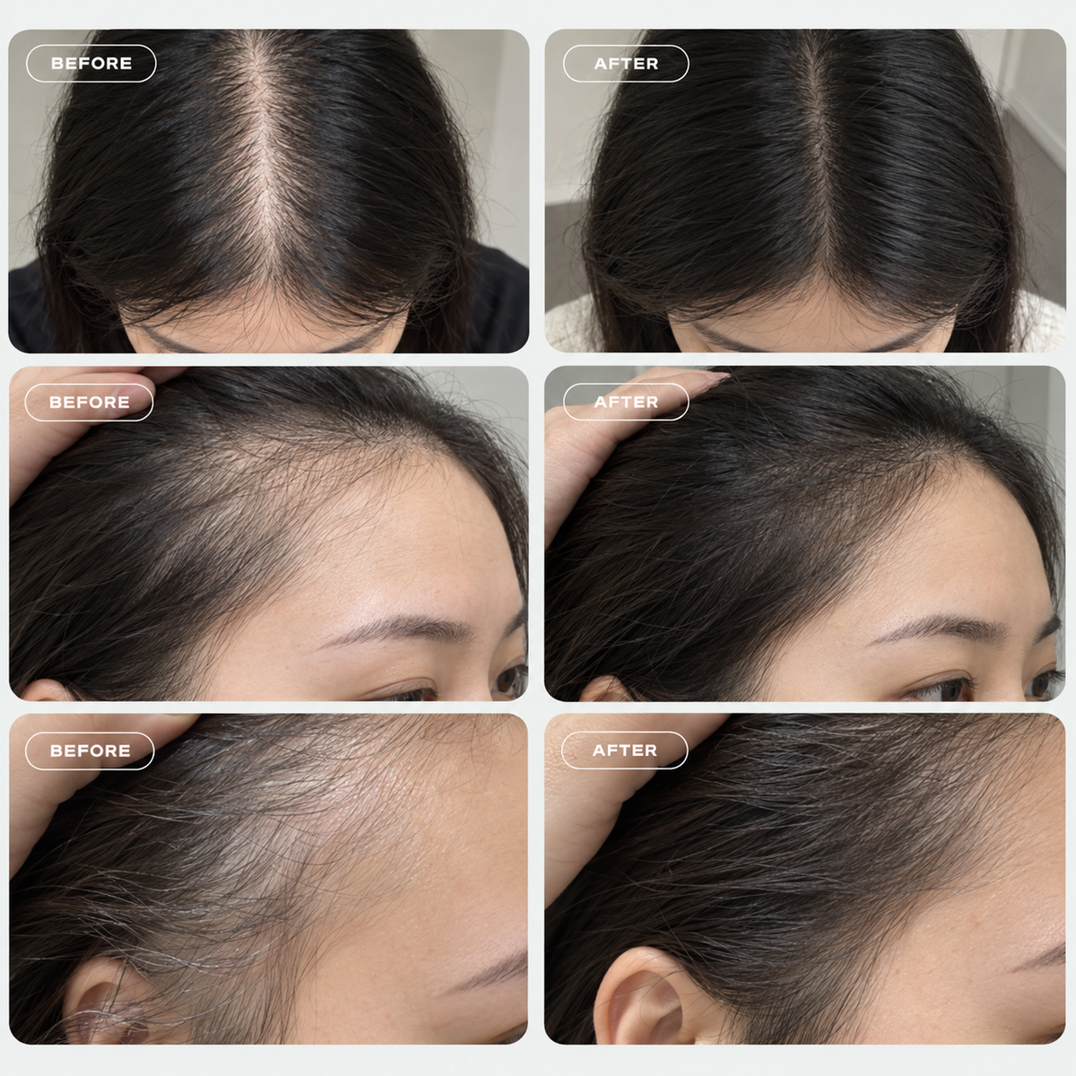 Hair Growth Revive Serum